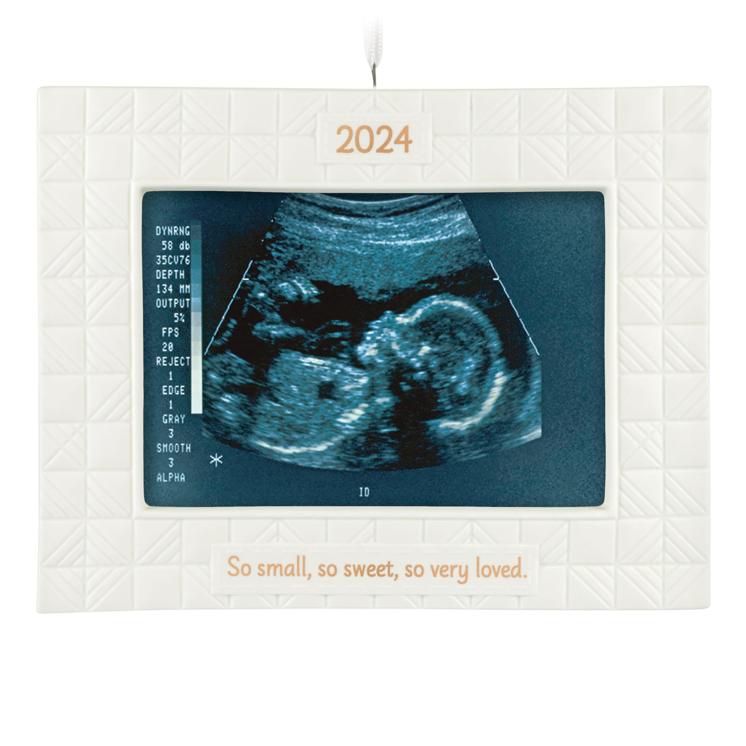Hallmark Keepsake Christmas Ornament 2024, So Very Loved Sonogram Photo Frame, Porcelain, Baby's 1st Christmas